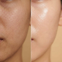Nuverex Rice Detox Serum